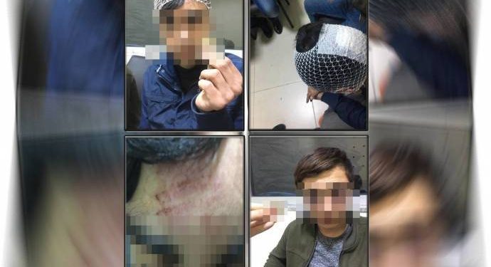 690x390cc v 18 02 2019 gozaltinda iskence rop naci duman