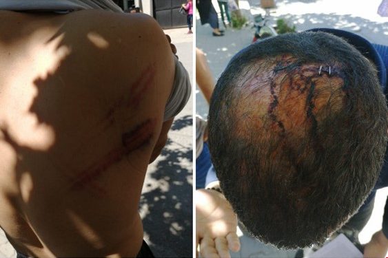 esenyurt karakol işkence.jpeg