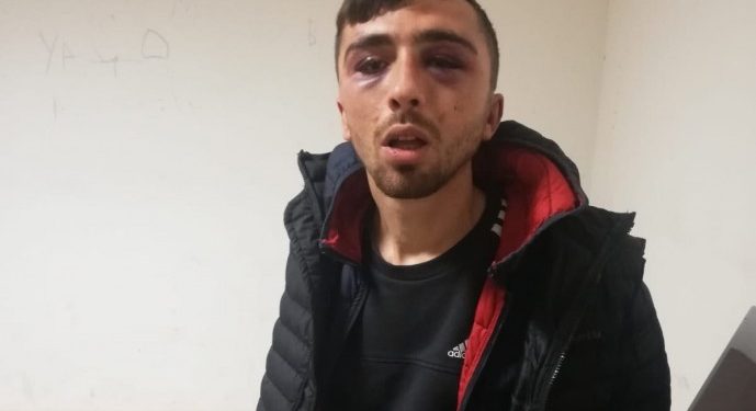 işkence diyarbakır