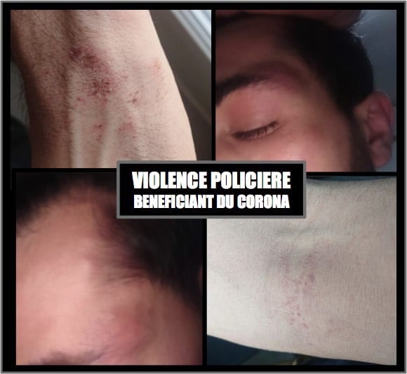 paris ırkçı saldırı