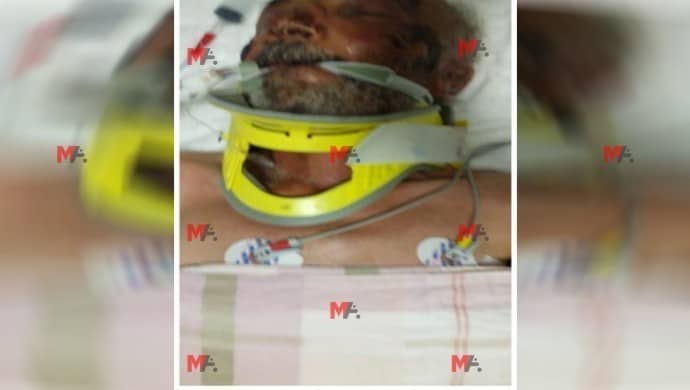 690x390cc v 27 09 2020 servet turgut yogun bakimda