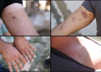 823x463cc 010821 konya aile yakinlari polis saldirisina ugradi manset