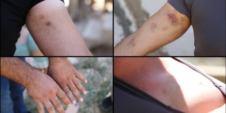 823x463cc 010821 konya aile yakinlari polis saldirisina ugradi manset