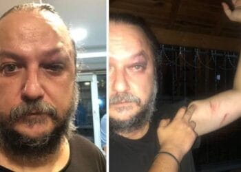 birgun gazetesi yazari guvenc dagustun saldiriya ugradi 916142 5 720x375 1