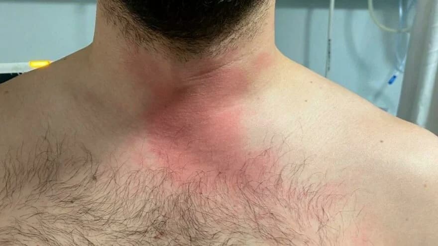 Doktora yönelik şiddet