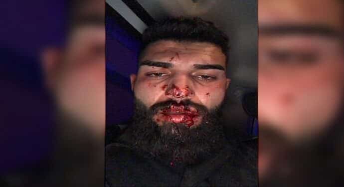 690x390cc drsm 13 04 2022 valilik polis iskencesini gormezden geldi