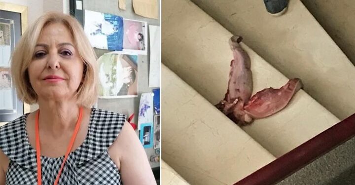 asi karsitlarinin hedefindeydi prof dr esin davutoglu senol un kapisina dana dili birakildi 1046922 5