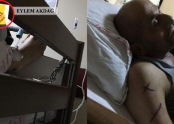 Kanser hastasi tutsak