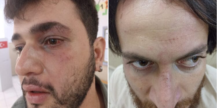 Antakyada usulsuzluklere itiraz eden musahitler darp edildi