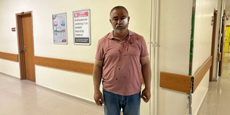 Mardinde Yesil Sol Parti musahitlerine saldiri