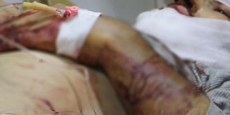 Kobaneye SIHA saldirisi