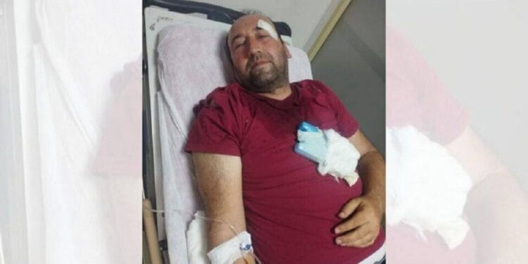 Urfa'da gazeteciye AKP'li başkanın korumasından darp ve tehdit: "Yazarsan ölürsün"