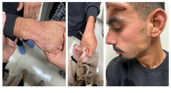 Polisler darp ettikleri zihinsel engelli gençten şikâyetçi oldu