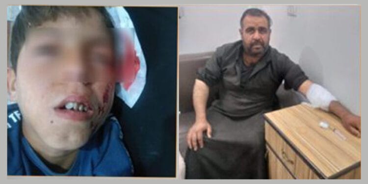 TC'nin Minbic'e saldırılarında 1'i çocuk 2 kişi yaralandı