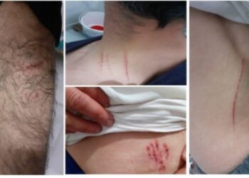 Bilirkişi, köpekli işkencede polisi "kusursuz" buldu