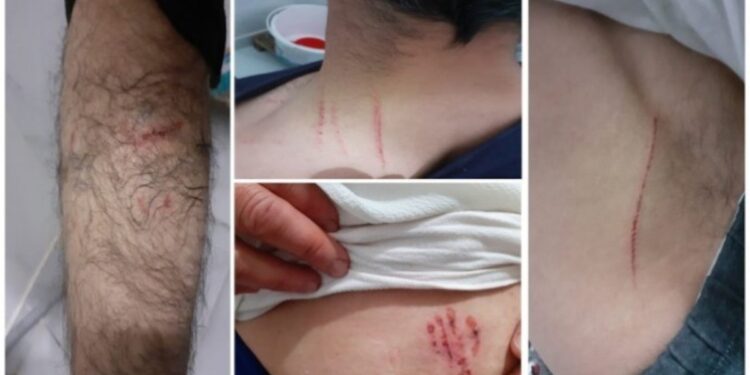 Bilirkişi, köpekli işkencede polisi "kusursuz" buldu