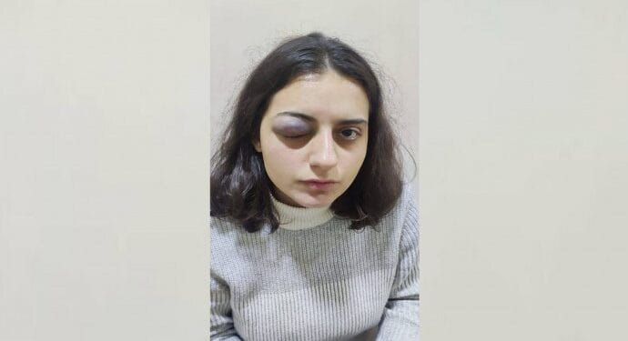 HEDEP Gençlik Meclisi Eş Sözcüsü Edanur İbrahimoğlu gözaltında işkenceye uğradı