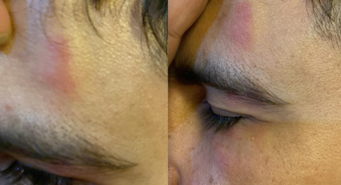 Puşi takan öğrenci saldırıya uğradı