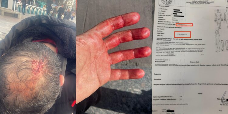 Maaşını isteyen öğretmen darp edildi