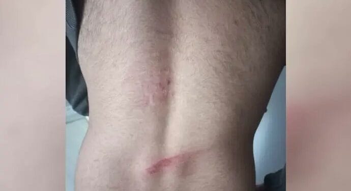 Ev baskınında işkence